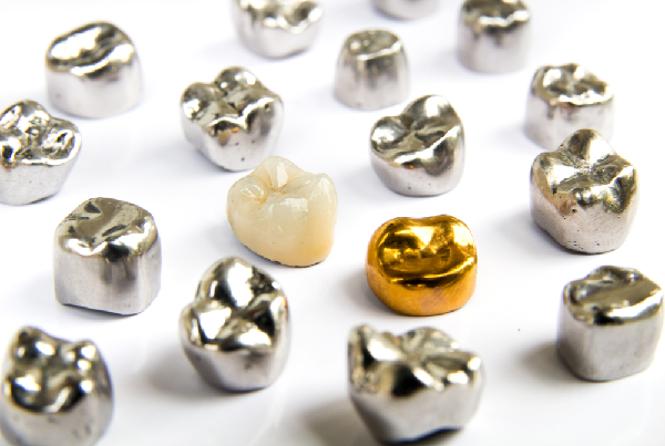 Stainless Steel And Aesthetic Crowns